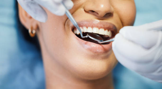 Best Holiday Emergency Dentist in Burton, MI