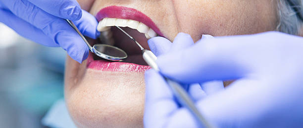 Best Emergency Dental Services for Seniors in Burton, MI