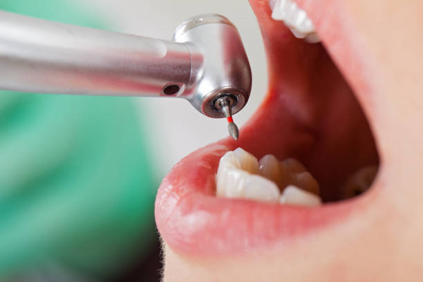 Best Emergency Dentist for Special Needs Patients in Burton, MI